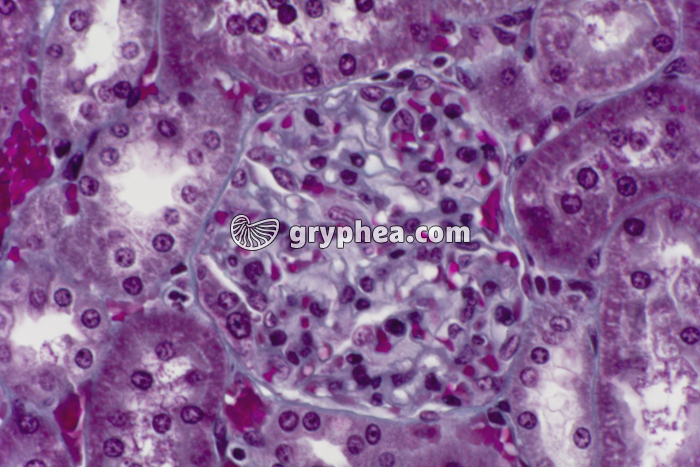 Rein Homme région des glomérules x200 - gryphea.com